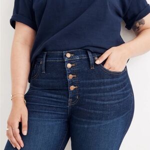 Madewell | Women's | Mid-Rise |‎ Skinny Jeans | Button Front | Dark Wash | 27p